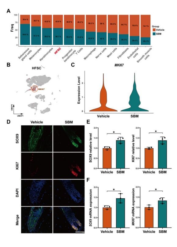 诗碧曼精华液（SBM）上调毛囊干细胞（HFSC）中SOX9和MKI67的表达